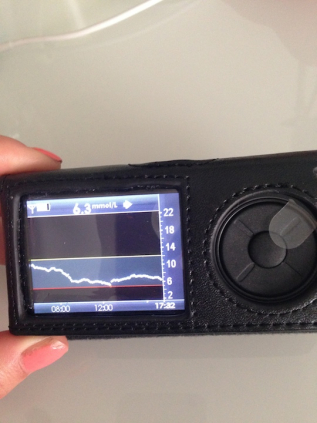 1st Day CGM graph - not bad!
