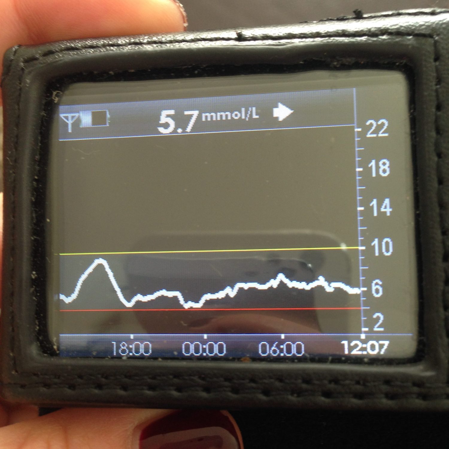 cgm_graph - Hanna Diabetes Expert